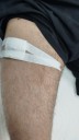 Un hombre resultó herido de bala en el barrio Antártida II y denunció al agresor