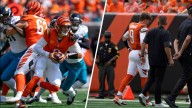 Bengals’ Joe Burrow could miss 3 months with possible toe surgery