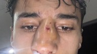 Se conoció la dura sanción que sufrió un jugador de la Liga Mendocina por agredir a un rival