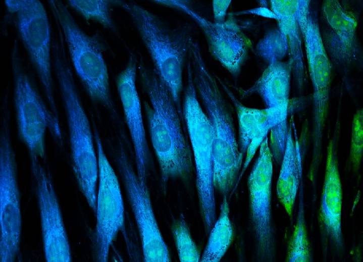 Fibroblasts Unveiled as Potential Drug Targets in Multiple Diseases