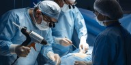 Científicos crean “pistola 3D” que imprime huesos en cirugías y acelera la regeneración ósea