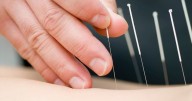 Acupuncture Beneficial for Chronic Low Back Pain in Older Adults