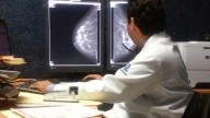 En Hidalgo, más de 500 personas contrajeron algún tipo de cáncer en 2025: SSH