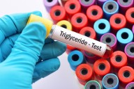 Health Alert: 50% of J&K Kids Aged 5-9 Show High Triglycerides, Says Govt Study