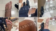 Las heridas de los antidisturbios en los incidentes de la Vuelta en Madrid
