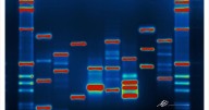 Knowing what’s in your DNA can save your life