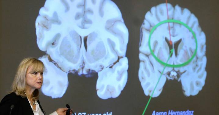 Here's what to know about CTE, the brain disease the NYC shooter blamed for his mental health issues