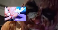 Pagano sufre dolorosas lesiones tras lucha extrema ¡Dedos terminan rebanados!