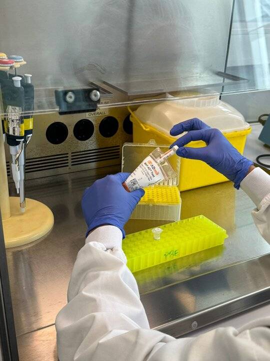 Desarrollan "el primer biomarcador en sangre" que anticipa la progresión hacia el Alzheimer
