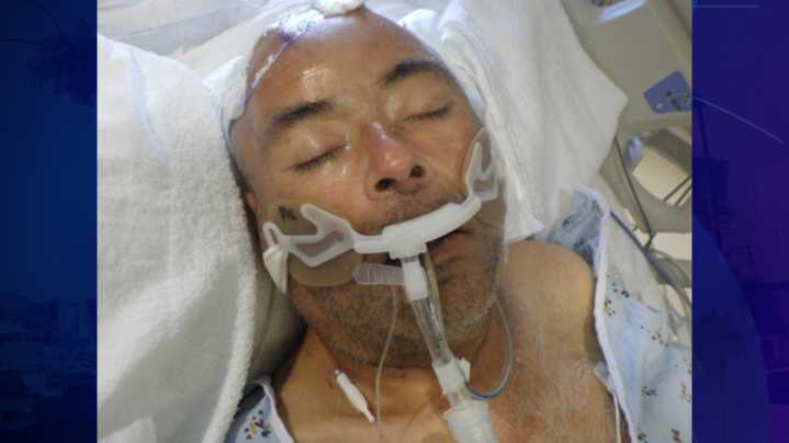 Hospital needs help identifying man found injured at Union Station in downtown L.A.