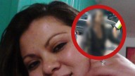 Explosión en Iztapalapa: ¿quién es Abril Díaz, la paciente que tiene quemaduras en todo el cuerpo