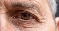 Analysis finds predictors of poorer acute optic neuritis outcomes