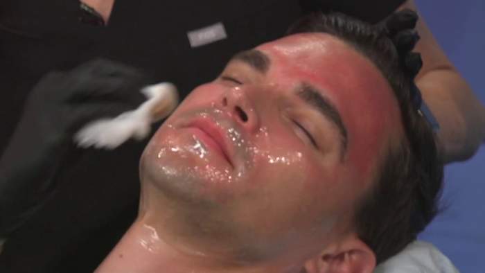 Refresh, rejuvenate and resurface: The latest skin treatments for reducing sun damage, improving skin tone and texture