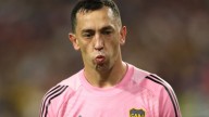 Agustín Marchesín se desgarró y en Boca se abre el interrogante: cuántas chances tiene Chiquito Romero de volver al arco