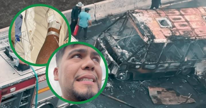 “Las flamas empezaron a quemarme”: Influencer narra su escape de la explosión en Iztapalapa