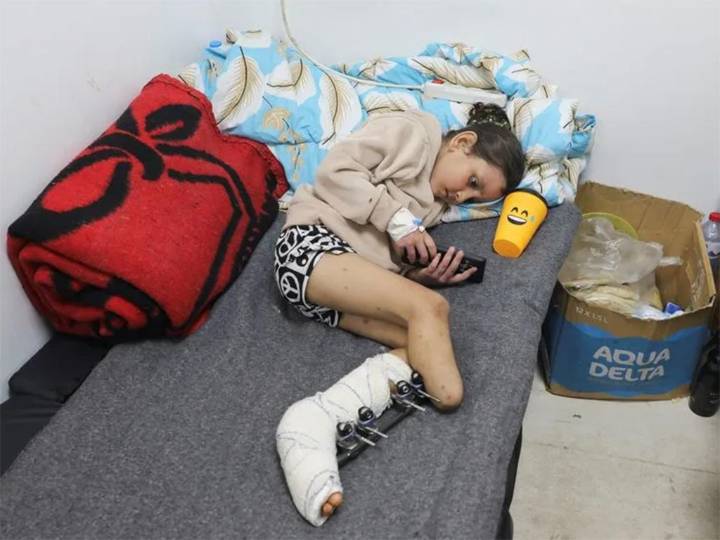 Crisis de medicamentos provocó aumento de amputaciones en Gaza