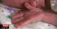 Illinois law could ensure families with NICU babies receive info on early intervention services