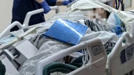 Chinese Woman Dies From Organ Failure After Stepping On ‘Bone