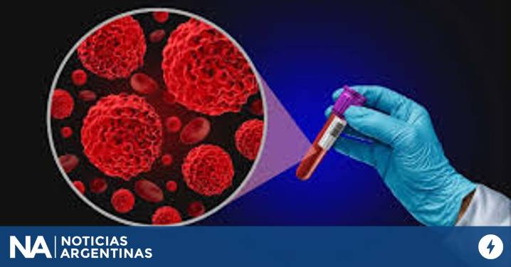Se diagnostican más de tres casos de mieloma múltiple por día en la Argentina