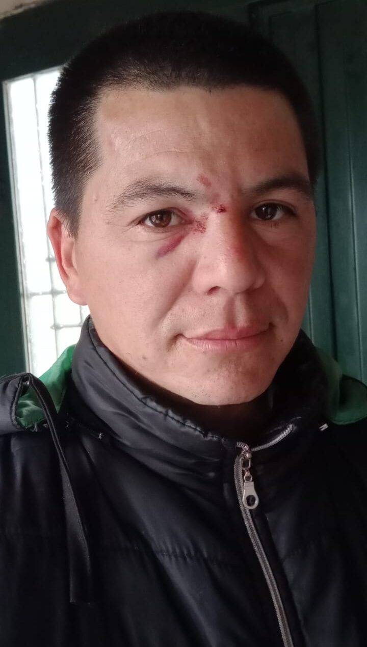 Feroz golpiza al referente de los recicladores de Villa de Merlo