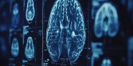 La neurociencia del cáncer: descubren cómo crece el tumor cerebral más frecuente en niños