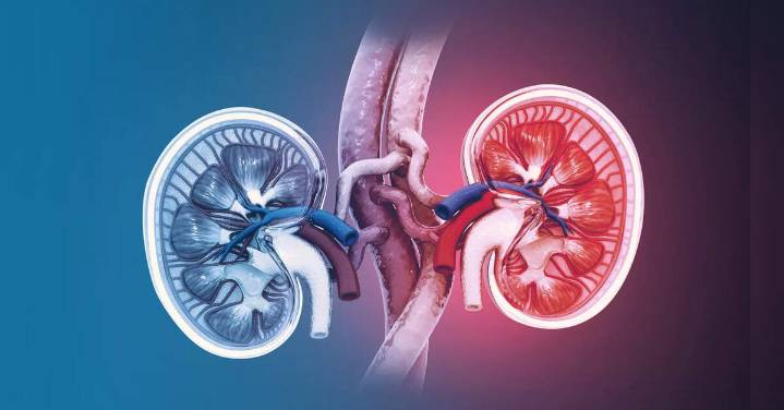 Study projects kidney cancer cases could double in next 25 years globally