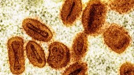La OMS levanta la emergencia internacional por la mpox ante el descenso de casos, aunque "la amenaza no ha terminado"