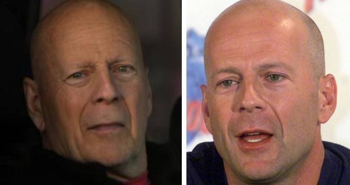 La esposa de Bruce Willis reveló como la salud del actor se agravó: comenzó con un antiguo trastorno