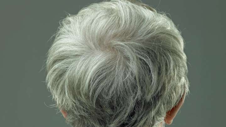 ¿Un futuro sin canas? Científicos chinos dicen haber inventado un tratamiento que revierte el pelo blanco