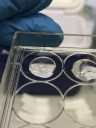 3D printed mini-placentas offer a new way to study pregnancy complications