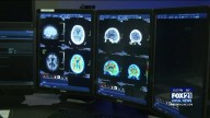 Essentia Health rolls out promising Alzheimer’s disease detection method