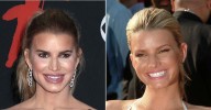 Plastic Surgeon Reveal Secrets Behind Jessica Simpson's New Face