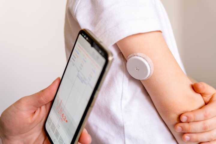 Continuous Glucose Monitoring Expands, Yet Access Remains Unequal