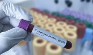 C-reactive Protein–Triglyceride Glucose Index Independently Predicts Stroke Risk in...