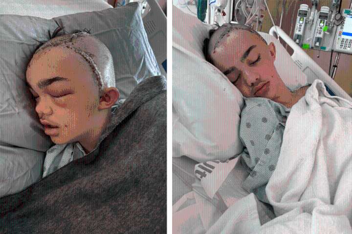 TIMELINE: How East Texas middle school student who suffered from skull fracture in cafeteria sparks outrage across community