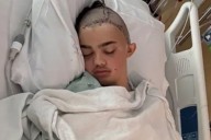 Middle Schooler Attacked by Student Over Joke, Has Parts of Skull Removed and 60 Staples Hold His Head Together