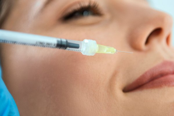 Los neuromoduladores no son para los labios (y aquí está la razón)