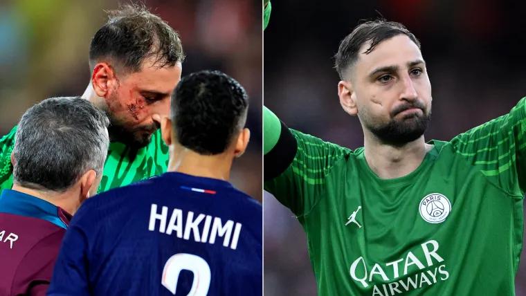 Why does Gianluigi Donnarumma have a scar on his face? Horror injury in Ligue 1 play doesn't draw yellow card
