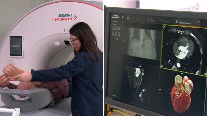 Revolutionary heart imaging technology arrives in western Sydney