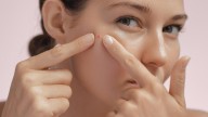 Parches para granos: acaba con esa incómoda marca en la cara fácil y rápido, sin hacerte una carnicería