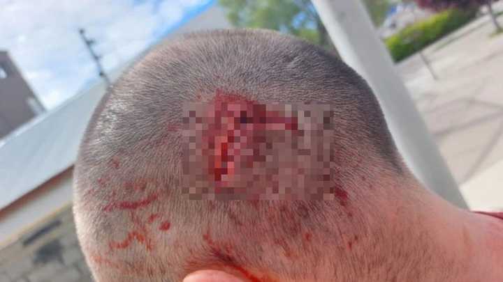 "No me mató de pedo", dijo el vecino atacado en Saavedra