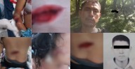 ¡Atroz intento de feminicidio en Sierra Sur! Mujer sobrevive a brutal ataque con machete por parte de su ex pareja