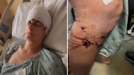 Texas woman survives brutal dog attack