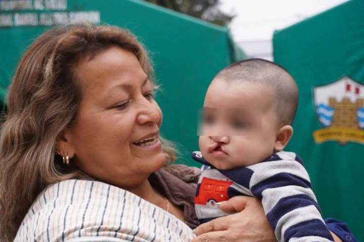 ¡Atención! Abren convocatoria para cirugías gratuitas de paladar hendido en el Callao