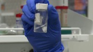 New gel could help chemo patients keep their hair