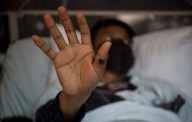 Levanta OMS alerta de emergencia sanitaria por viruela símica