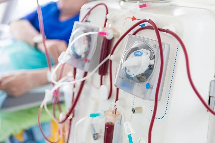 Predialysis Nephrology Care Disparities Contribute to Vascular Access