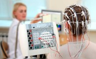 Nueva herramienta de inteligencia artificial ayuda a localizar lesiones en niños con epilepsia