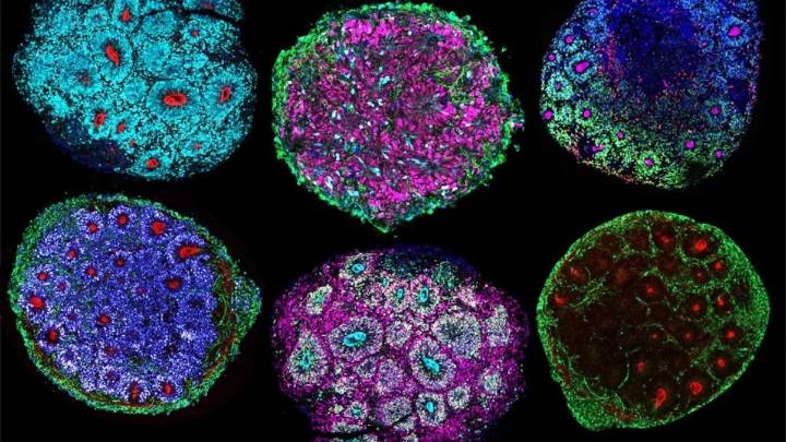 Los organoides cerebrales podrían adquirir consciencia y sentir dolor: ¿estamos preparados?