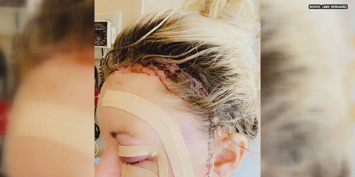 SHARED BATTLE: Oro Valley sisters survive multiple brain aneurysms